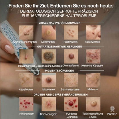 Offizieller Markenstore |✅𝑷𝑖𝒄𝐝𝐨® 🍁💖7-𝑻𝒂𝒈𝒆 𝑯𝒂𝒖𝒕𝒂𝒏𝒉ä𝒏𝒈𝒔𝒆𝒍- & 𝑭𝒍𝒆𝒄𝒌𝒆𝒏𝒆𝒏𝒕𝒇𝒆𝒓𝒏𝒆𝒓(Schmerzfreier Rollerball – Keine Narbenbildung)