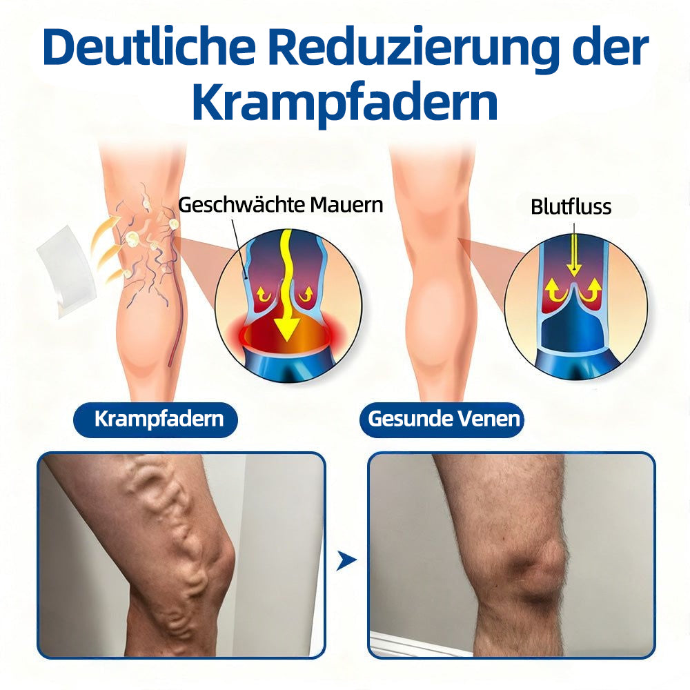 ✨👍𝐅𝐥𝐨𝐫𝐢𝐬𝐦𝐚®𝐕𝐞𝐧𝐞𝐧-𝐙𝐢𝐞𝐥 𝐌𝐢𝐤𝐫𝐨𝐧𝐚𝐝𝐞𝐥𝐩𝐟𝐥𝐚𝐬𝐭𝐞𝐫⚡Sofortige Linderung, langfristige Ergebnisse